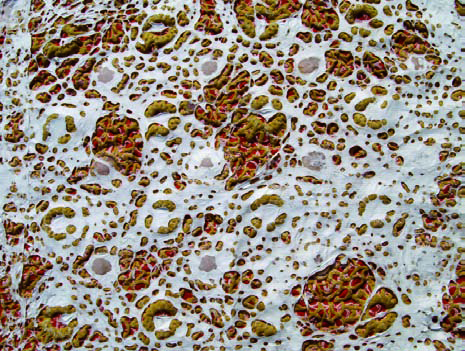Touch, Catharina Ibe, Crust